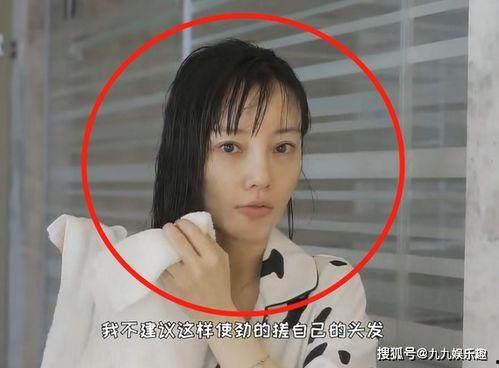 张凯毅爆料整容视频大全,视频大全曝光惊人变化 第1张 张凯毅爆料整容视频大全,视频大全曝光惊人变化 第1张