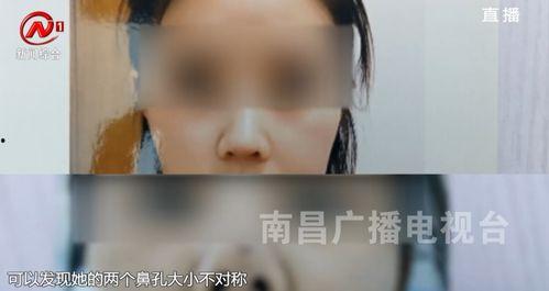 南昌医美爆料事件视频曝光,揭秘行业乱象与患者权益受损  第3张